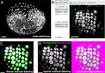 LABKIT: Labeling and Segmentation Toolkit for Big Image Data